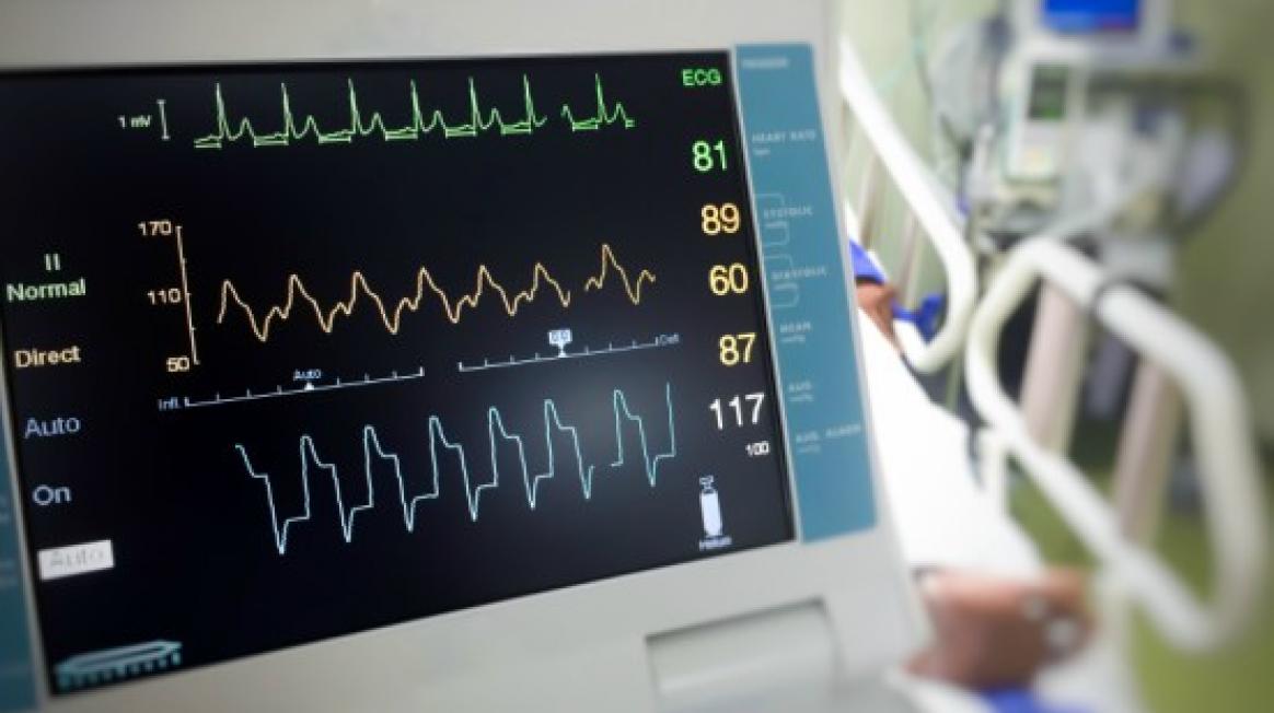 electrocardiogrames